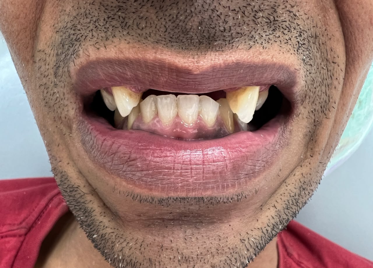 Antes do tratamento odontológico - caso 1