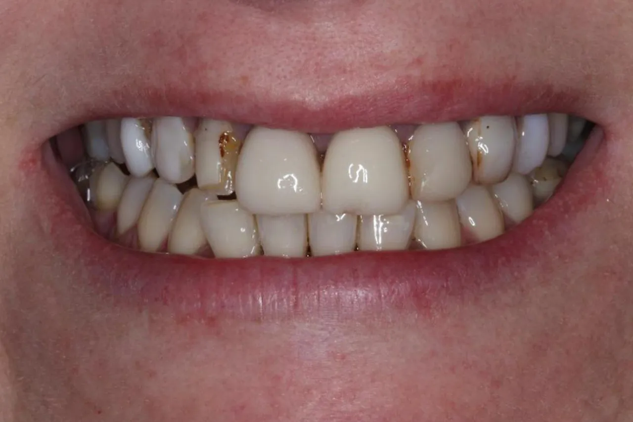 Antes do tratamento odontológico - caso 0