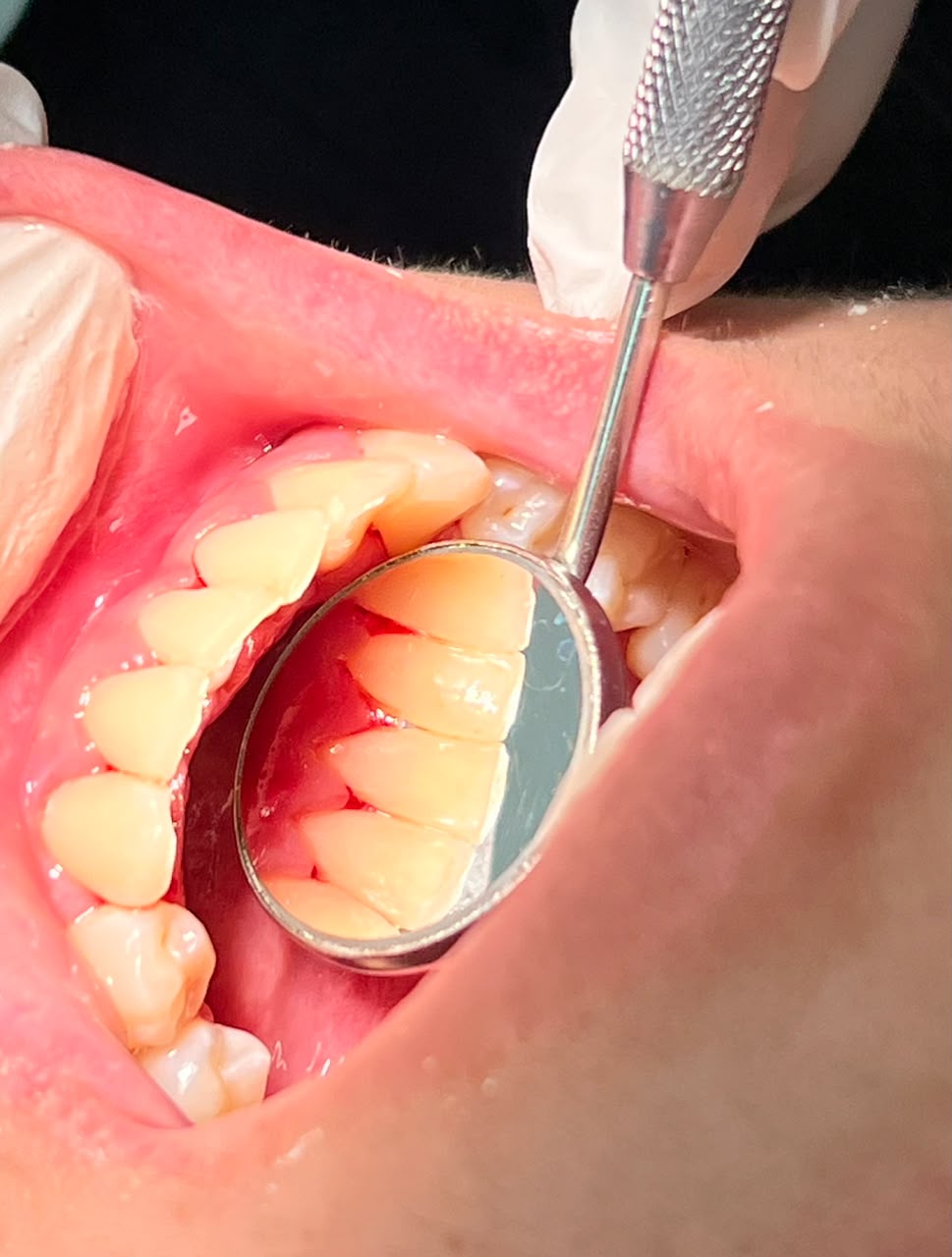Depois do tratamento odontológico - caso 2