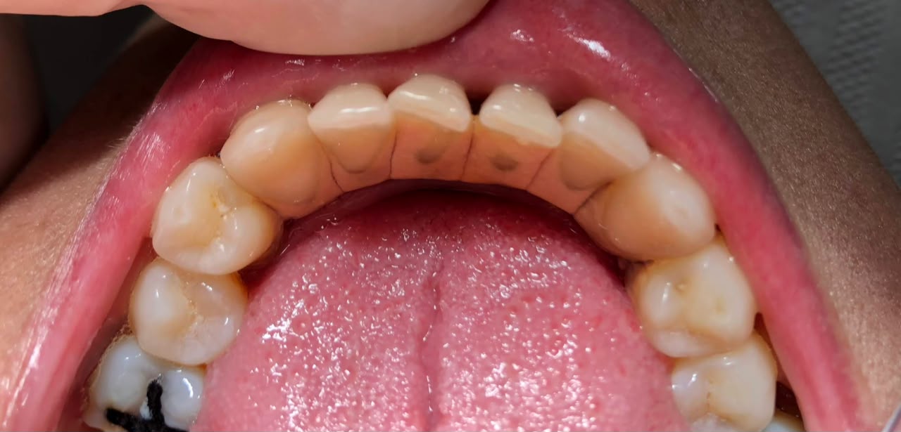 Antes do tratamento odontológico - caso 3